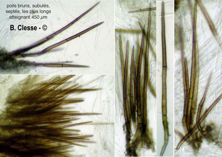 Trichophaea gregaria