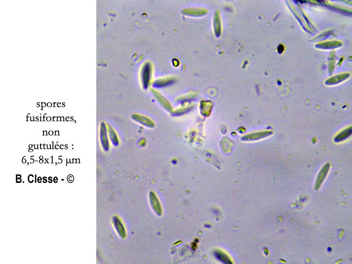 Dasyscyphella nivea