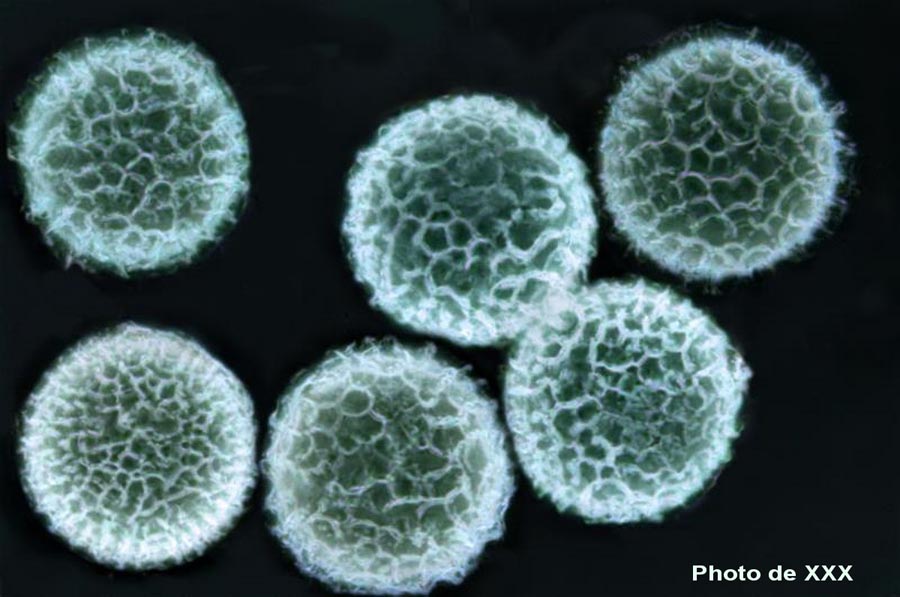 Elaphomyces cyanosporus