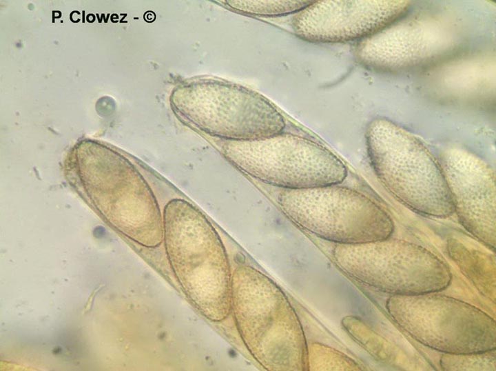 Leucoscypha leucotricha