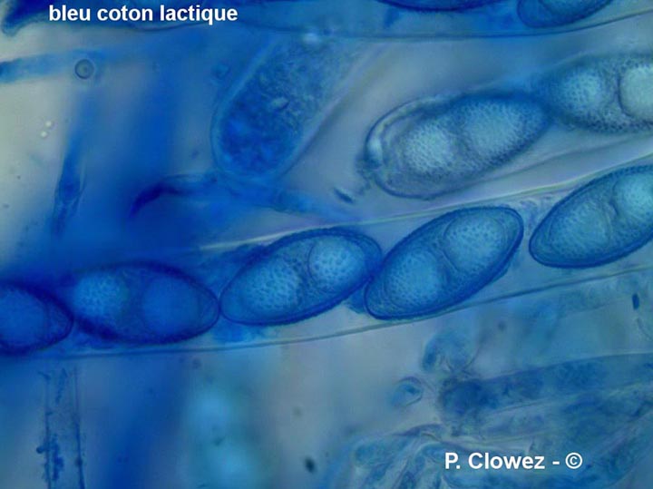 Leucoscypha leucotricha