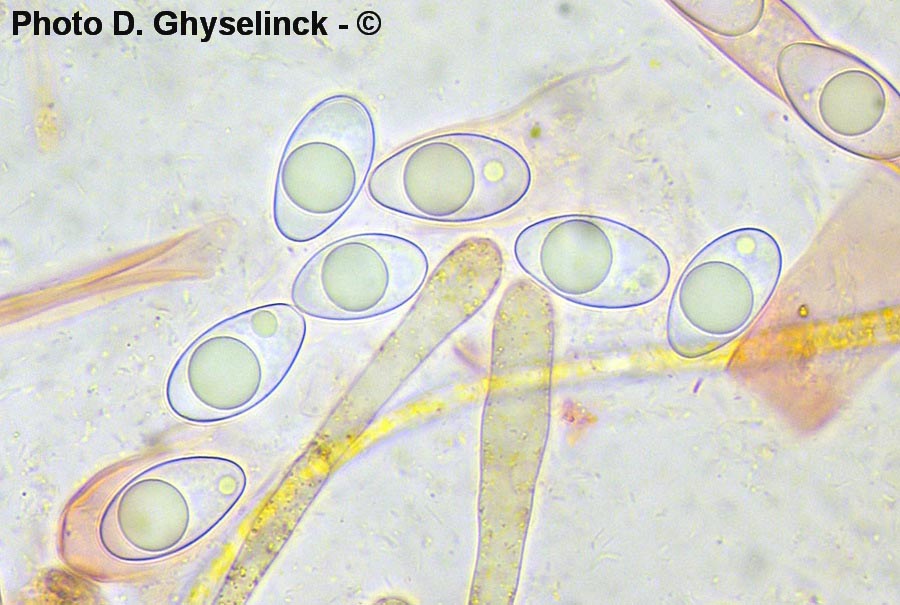Octospora gyalectoides