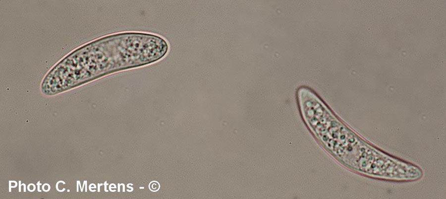 Pezicula myrtillina