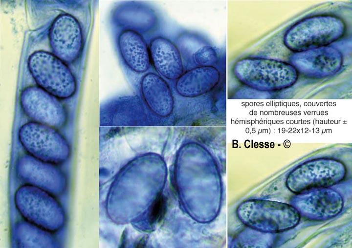 Scutellinia olivascens