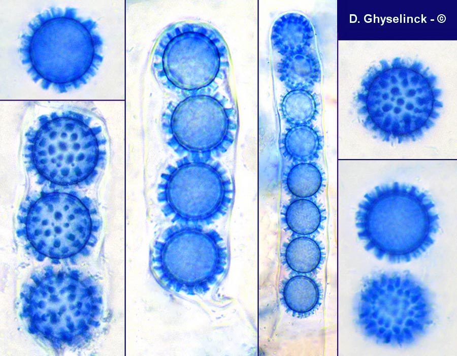 Scutellinia trechispora