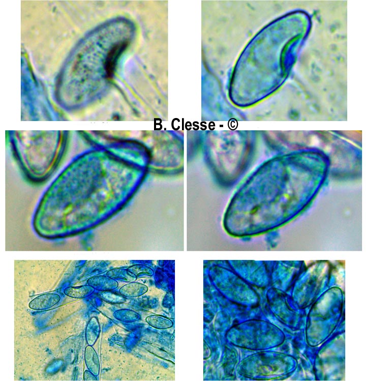 Trichophaea gregaria