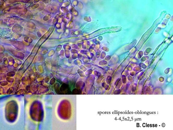 Amphinema byssoides