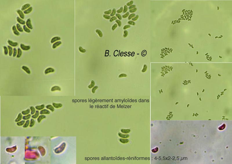 Amyloxenasma grisellum