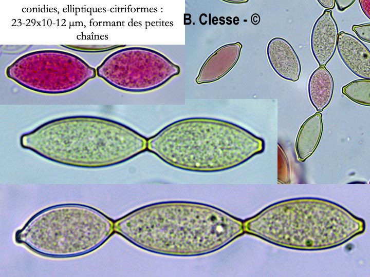 Botryobasidium aureum