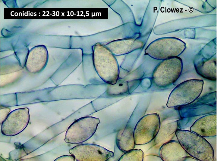 Botryobasidium aureum