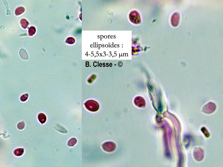 Hyphodontia alutaria