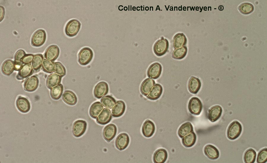 Macrolepiota rhacodes (Chlorophyllum brunneum)