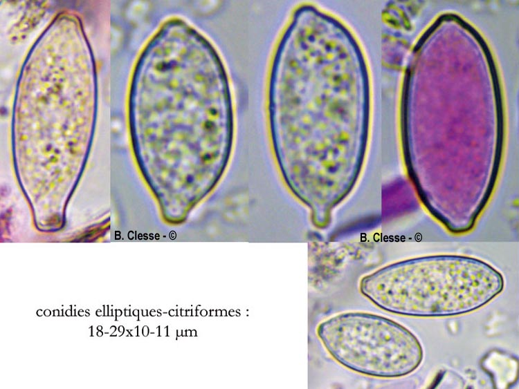Botryobasidium subcoronatum