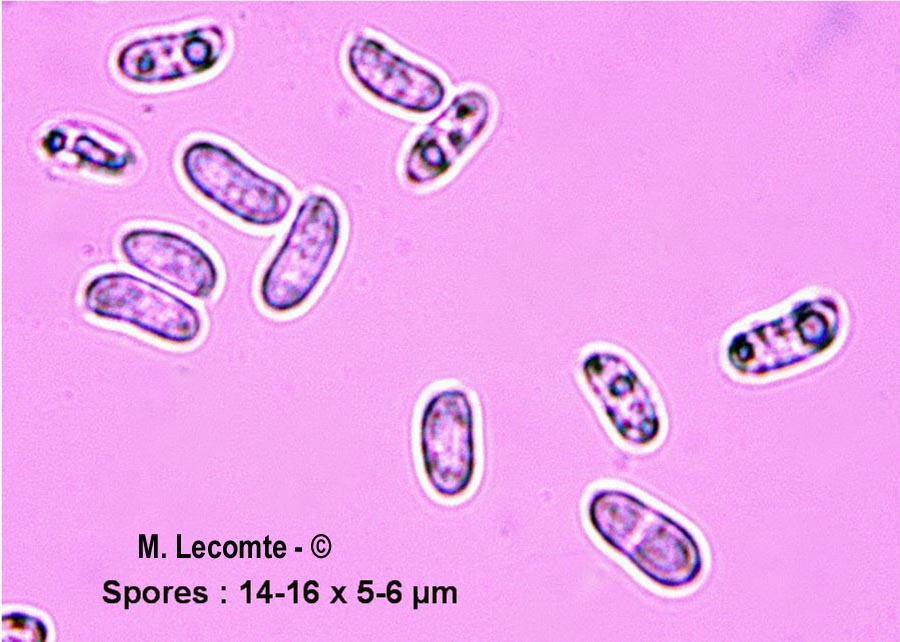 Megalocystidium leucoxanthum