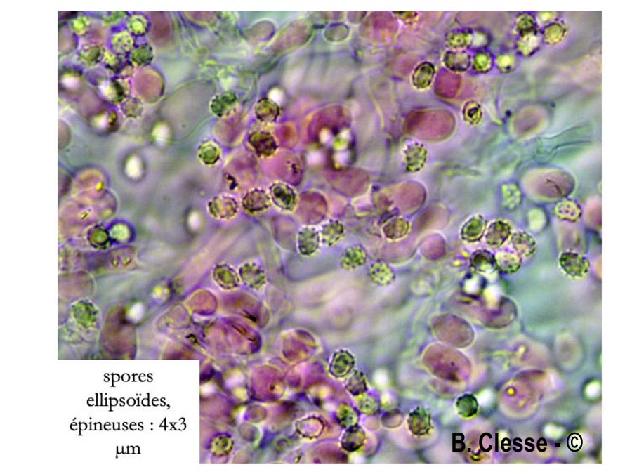 Trechispora hymenocystis