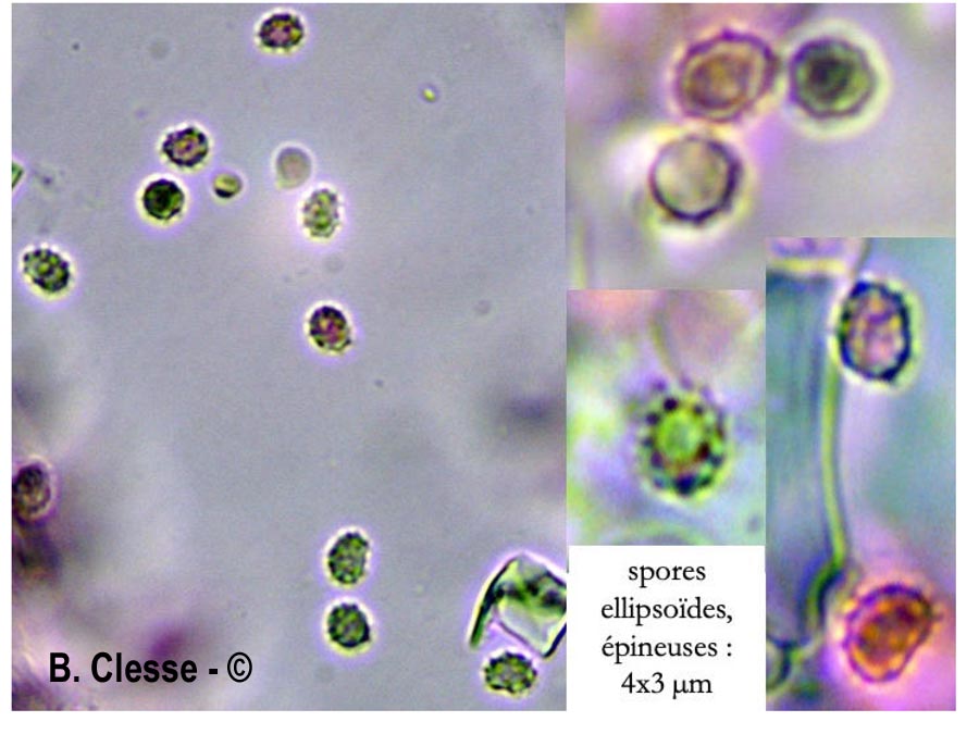 Trechispora hymenocystis