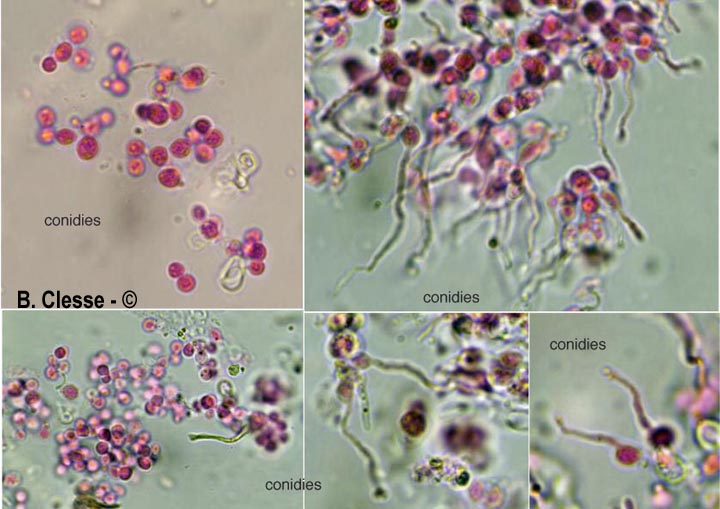 Tremella versicolor