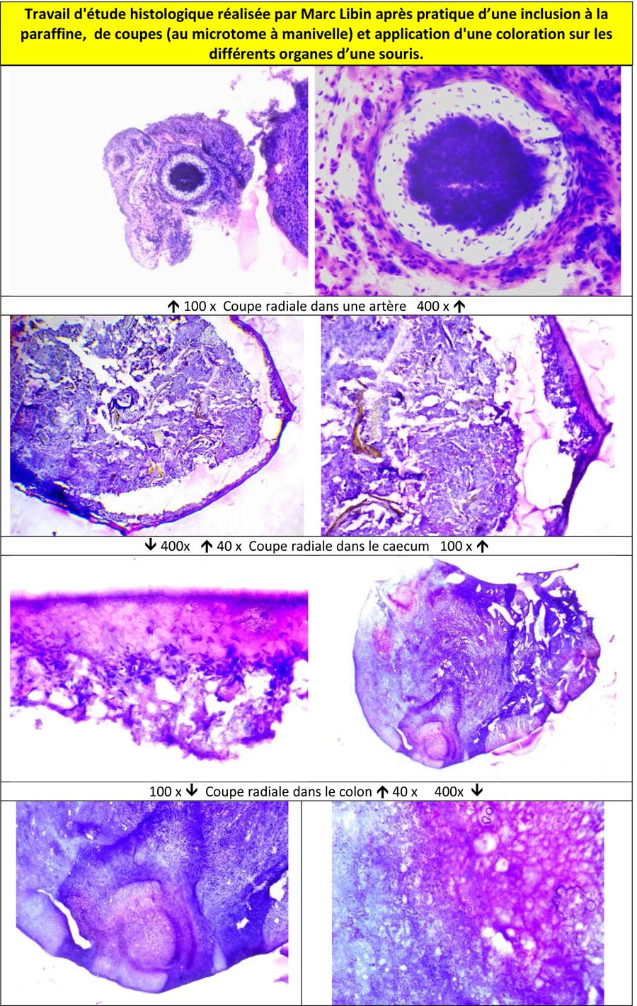 Travail d'étude histologique après pratique d’une inclusion à la paraffine, de coupes (au microtome à manivelle) et application d'une coloration sur les différents organes d’une souris