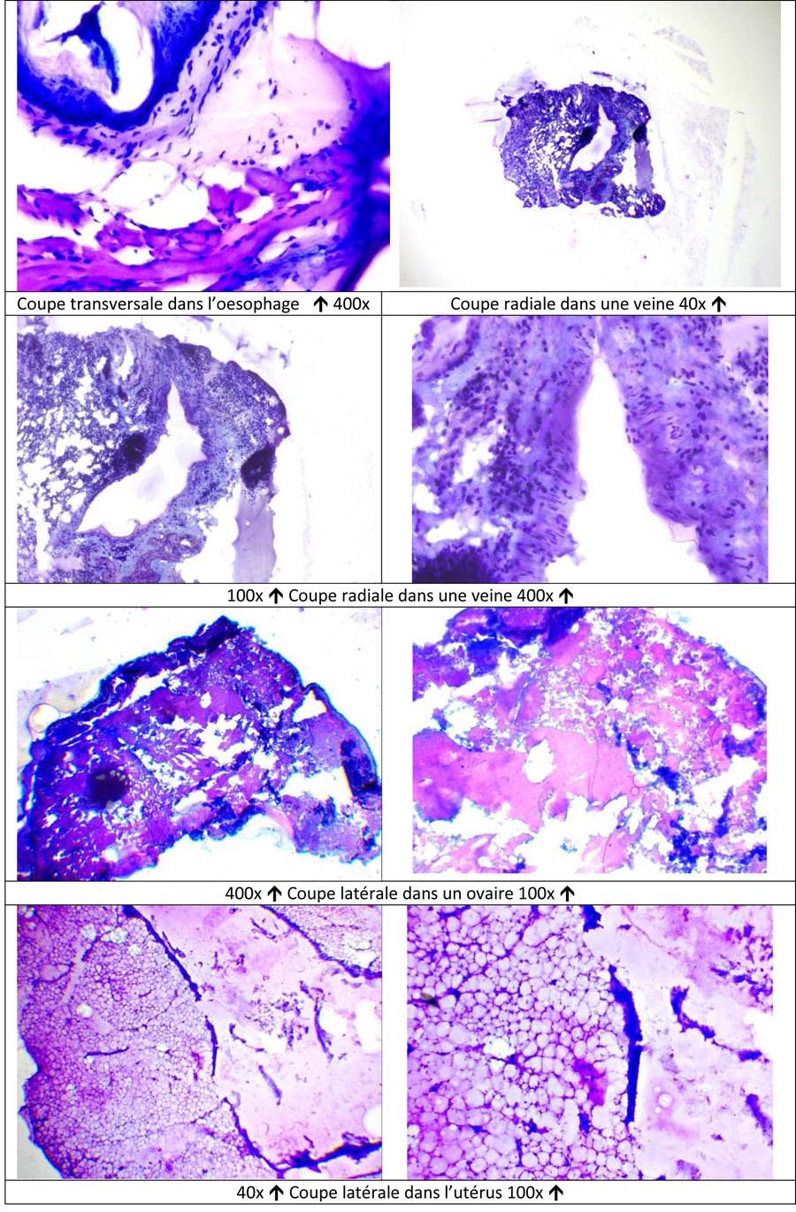 Travail d'étude histologique après pratique d’une inclusion à la paraffine, de coupes (au microtome à manivelle) et application d'une coloration sur les différents organes d’une souris