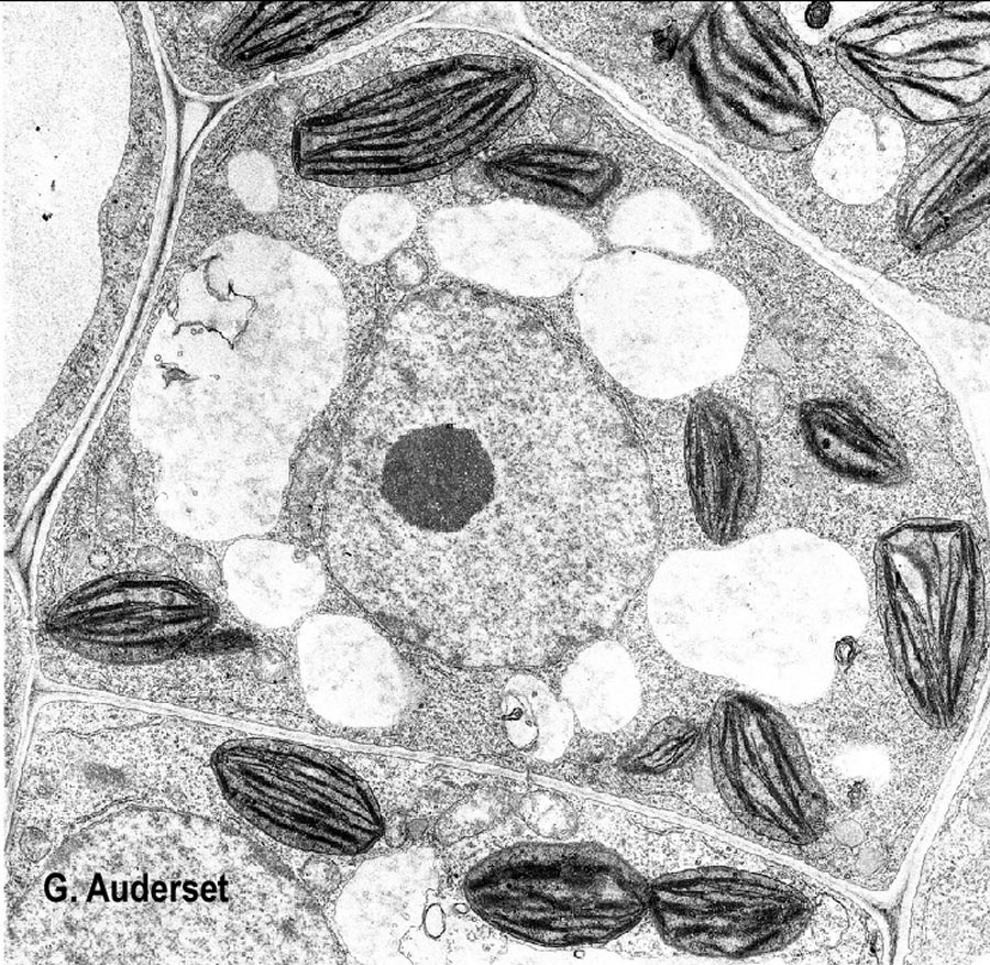 Cellule de soja vue au microscope électronique (G. Auderset)