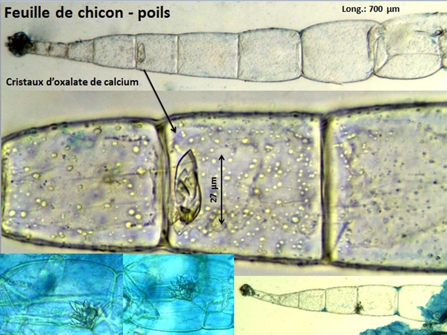 Chicon (Cichorium sp.) poils de la feuille