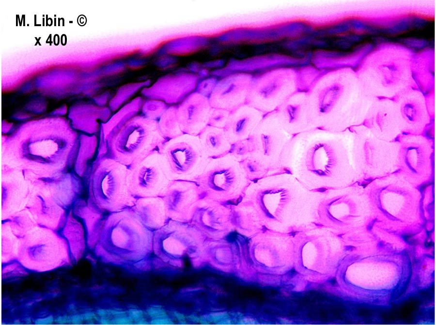 Linum usitatissimum