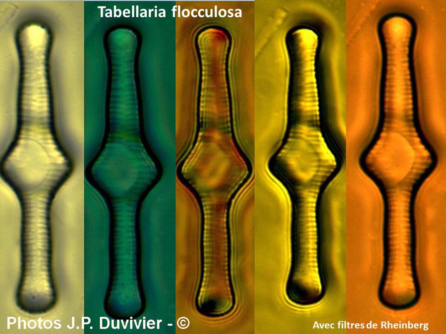 Tabellaria flocculosa rheinberg