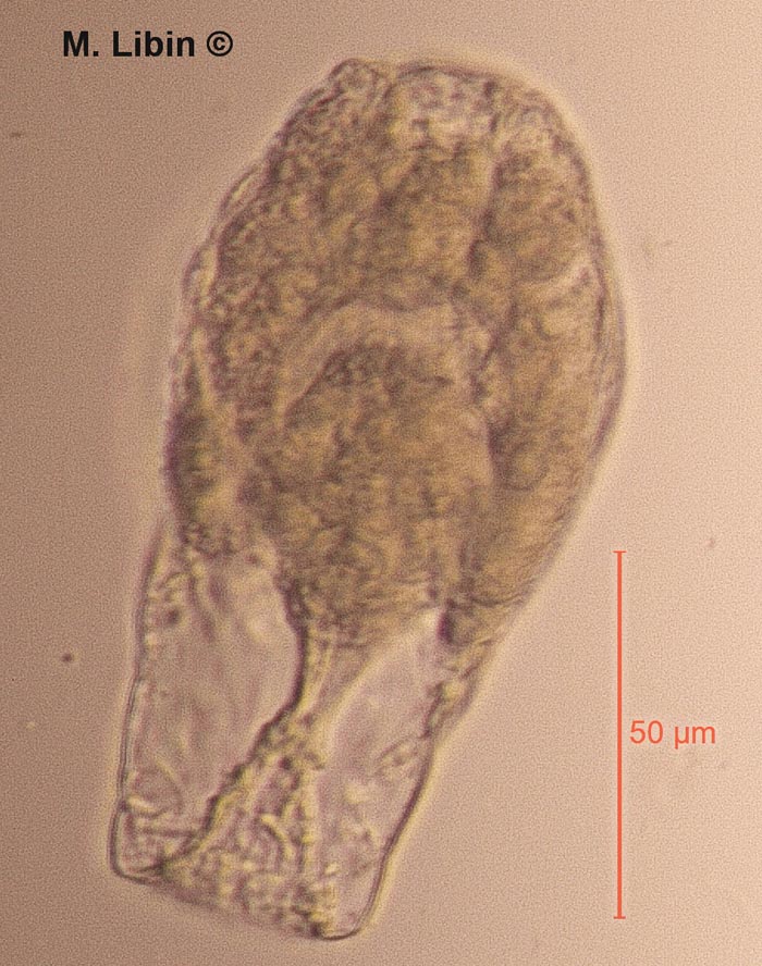 Difflugia lanceolata