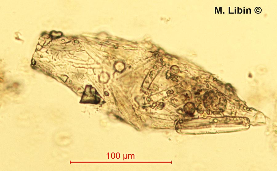 Difflugia scapellum